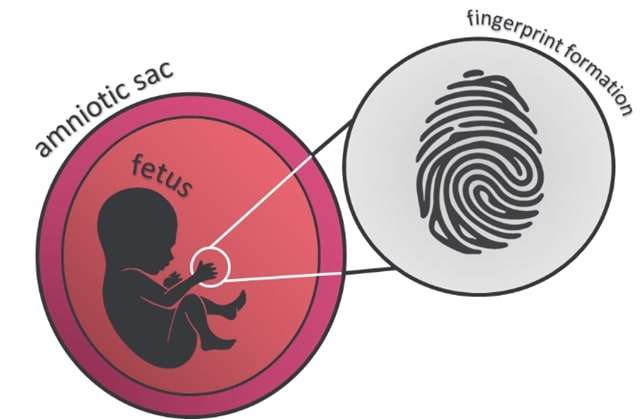 amniotic sac